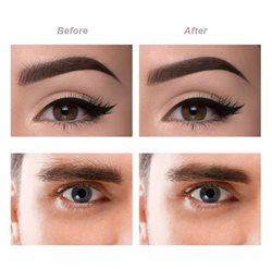 מכשיר להסרת שיער פנים, גבות, שפם